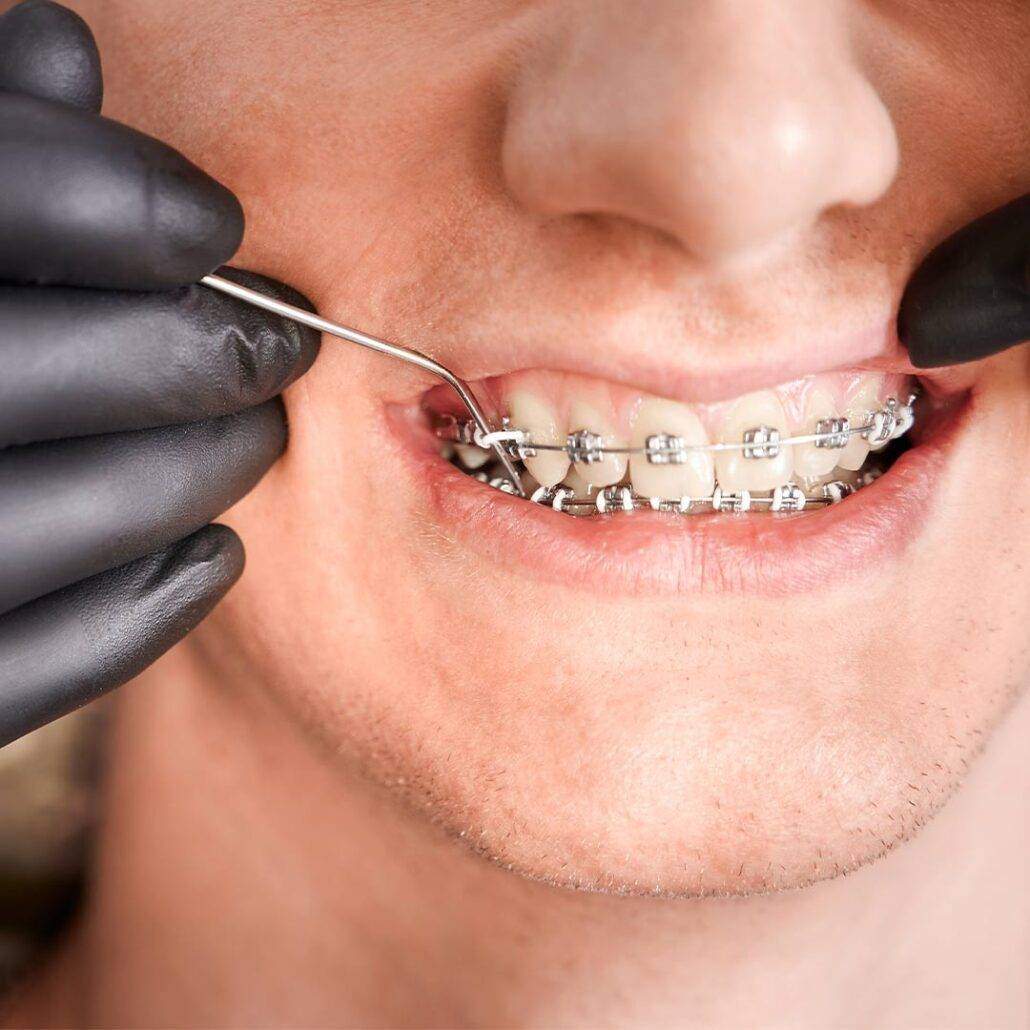 dentista centro sp, dentista centro são paulo, dentista av. angelica, dentista avenida angelica, dentista avenida paulista, dentista av paulista, dentista higienopolis, dentista santa cecilia, dentista consolacao, dentista metro consolação