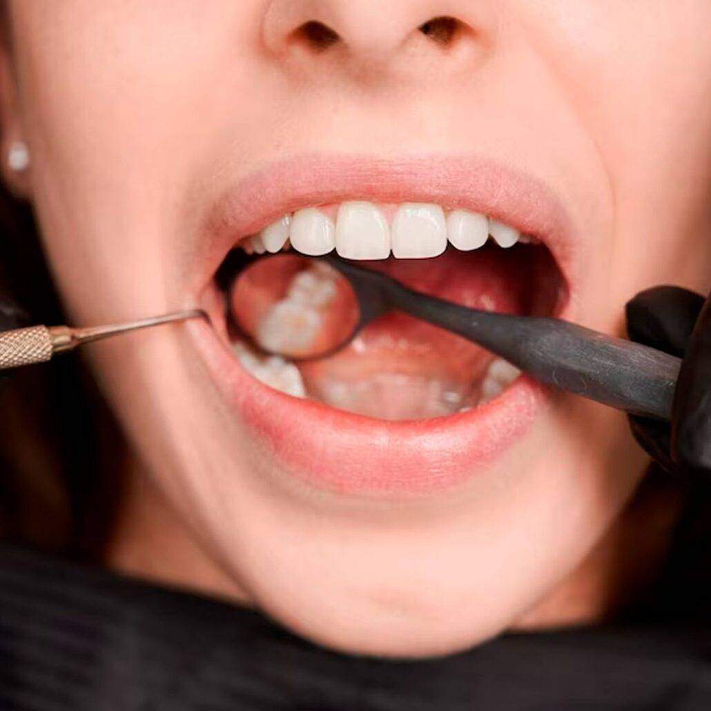 dentista centro sp, dentista centro são paulo, dentista av. angelica, dentista avenida angelica, dentista avenida paulista, dentista av paulista, dentista higienopolis, dentista santa cecilia, dentista consolacao, dentista metro consolação